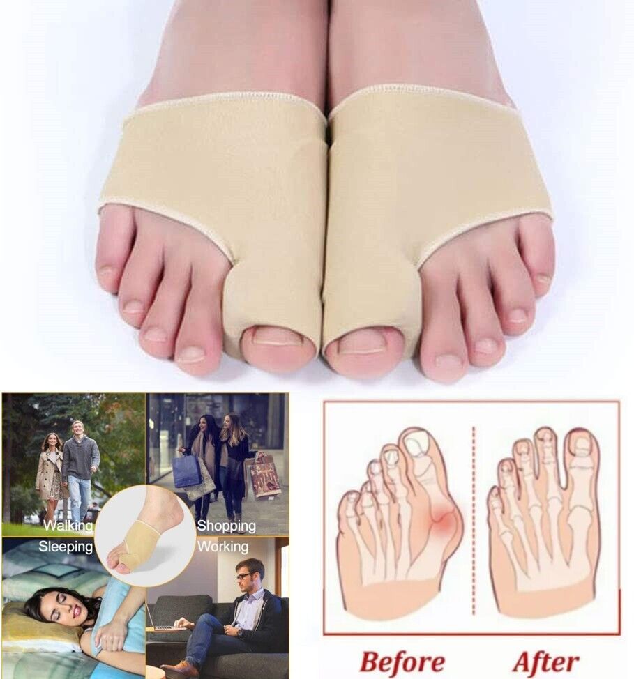 OrthoToe™ I 2e set gratis!
